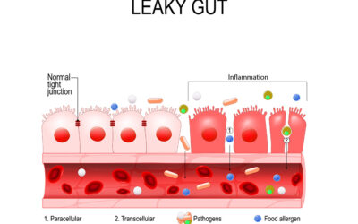Is the Gut the Key to Healing Autoimmunity?